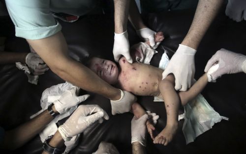 İsrail vahşetinin görüntüleri 17