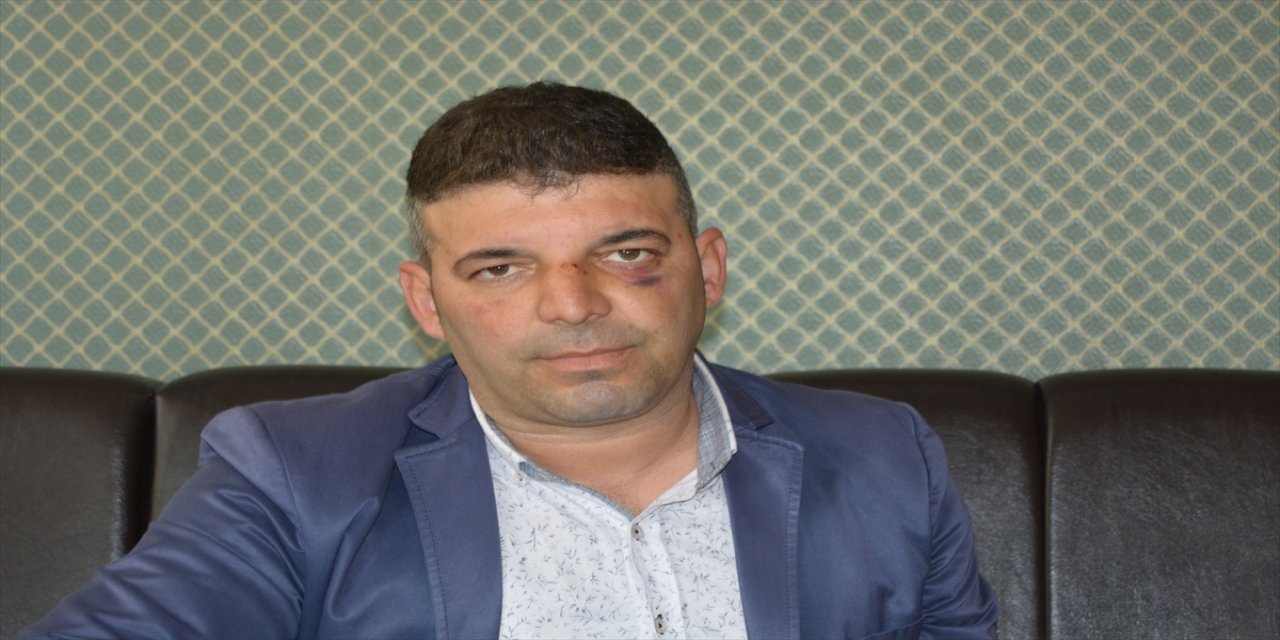 Düğünde çocukların oyun alanından alınmasını isteyen müzisyen darbedildi