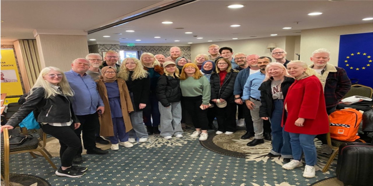 Albinizmli gençler Ankara'da yapılan etkinlikte bir araya geldi.