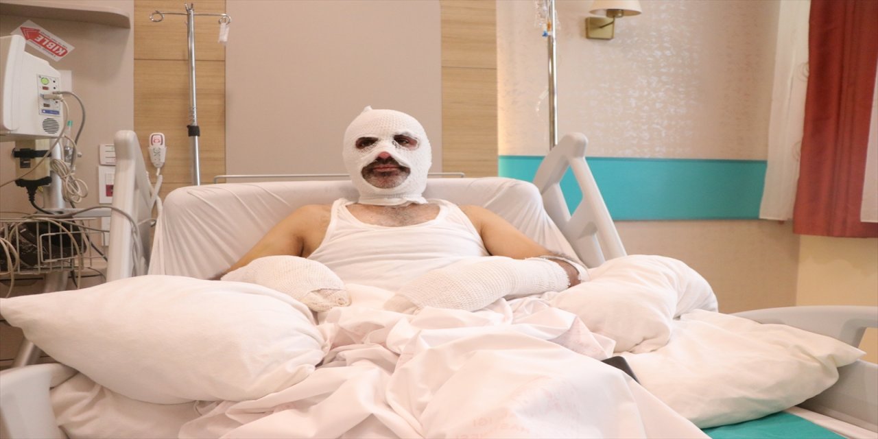 Gaz kaçağını fark etmediği tüpü yakınca canından oluyordu.