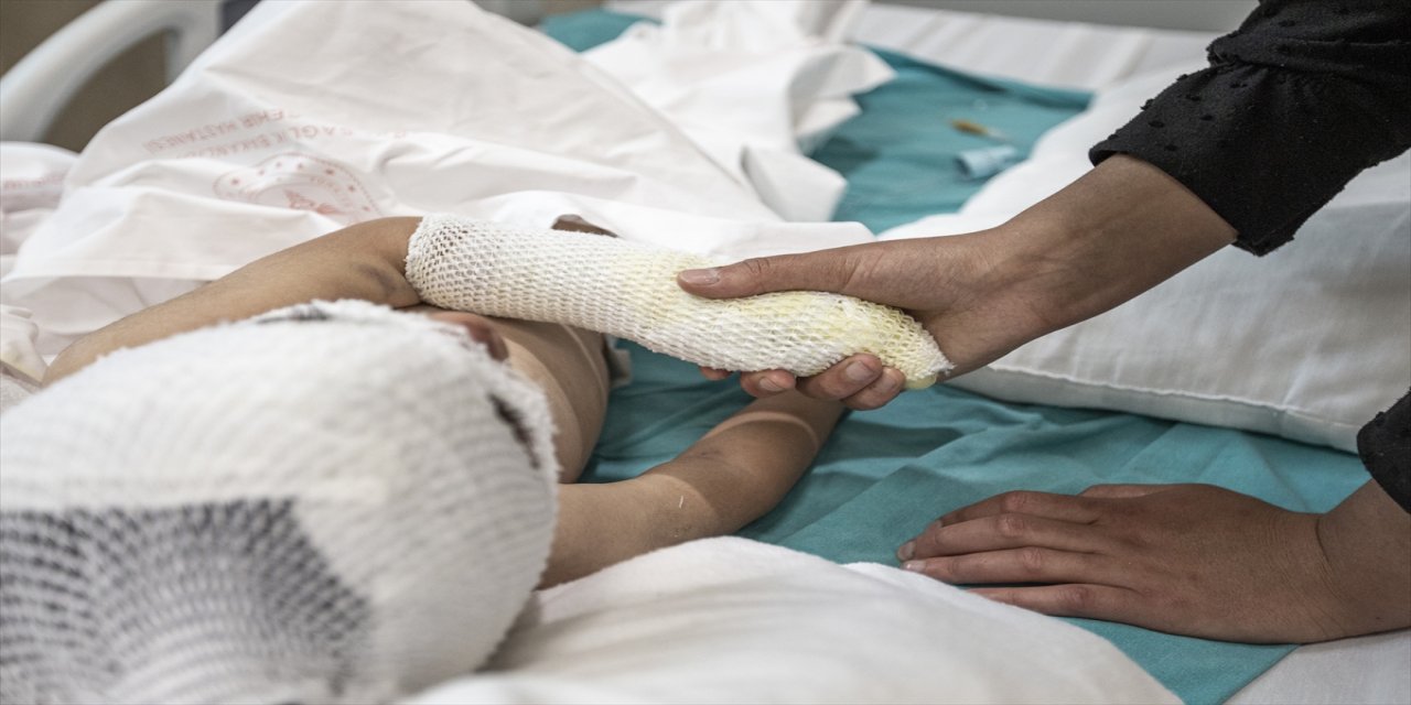 Çizgi film izlerken çıkan yangında yaralanan kuzenlerin tedavisi devam ediyor.