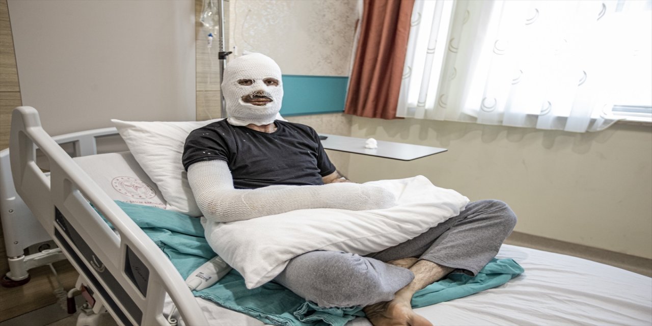 Tamir ettiği trafoda tedbir almasına rağmen yaşanan patlamada ağır yaralandı