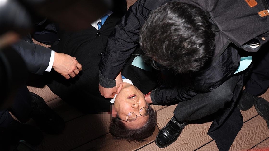 Ana muhalefet lideri bıçaklı saldırıya uğradı