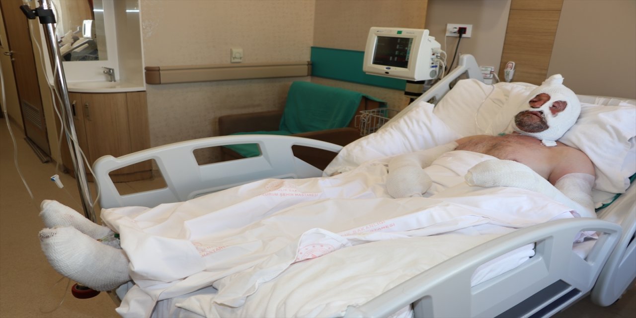 "Olayın etkisinden kurtulamıyorum, rüyama geliyor, kabus görüyorum."