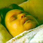 Uyku Apnesi Felç'e neden oluyor