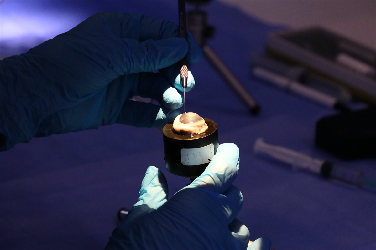 Ekran izleme süresinin uzaması göz kuruluğu ve şaşılık riskini artırıyor