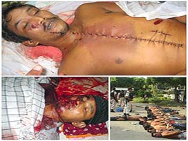 Patani'li Müslümanlar Kıyımdan Geçiriliyor