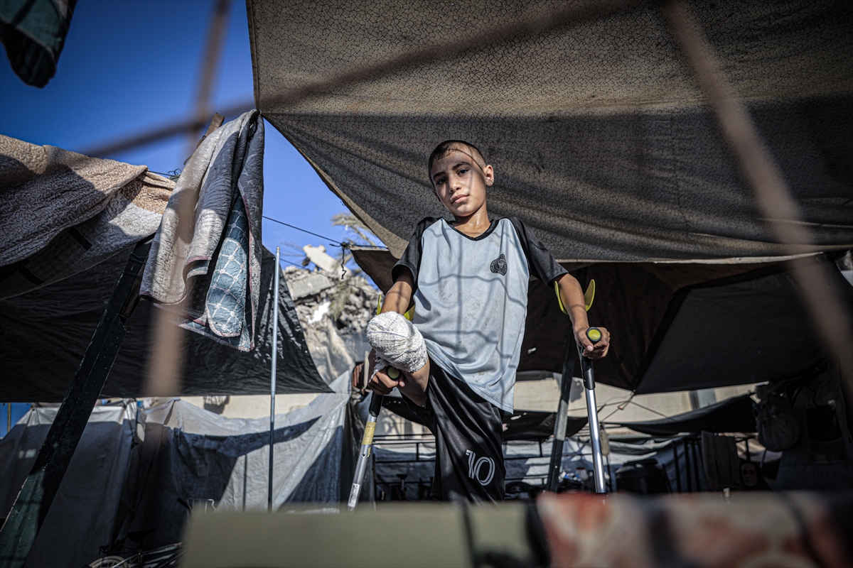 Yardım dağıtım noktasına giderken İsrail saldırısında ayağını kaybeden Gazzeli çocuk, eski günlerin özlemiyle yaşıyor