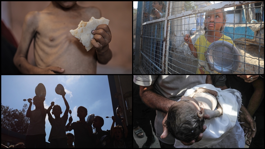 İsrail saldırıları ve ablukası altındaki Gazze'de açlıktan çocuk ölümleri artıyor