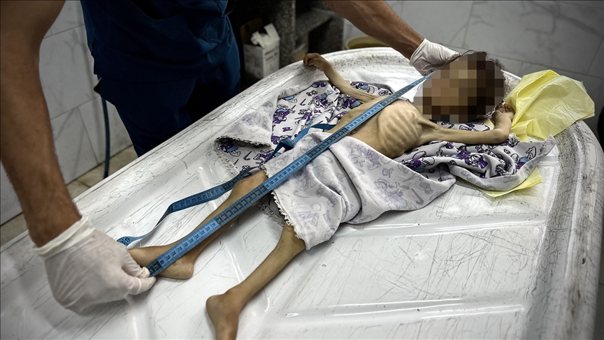 İngiliz patolog, Gazze'deki sefaletin "bir halkın diğerine neler yapabileceğini" gözler önüne serdiğini söyledi: