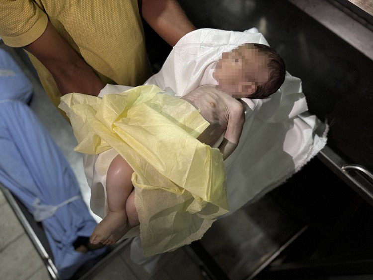 BM: Gazze'de kıtlığın yayılmasını engellemek için zaman daralıyor