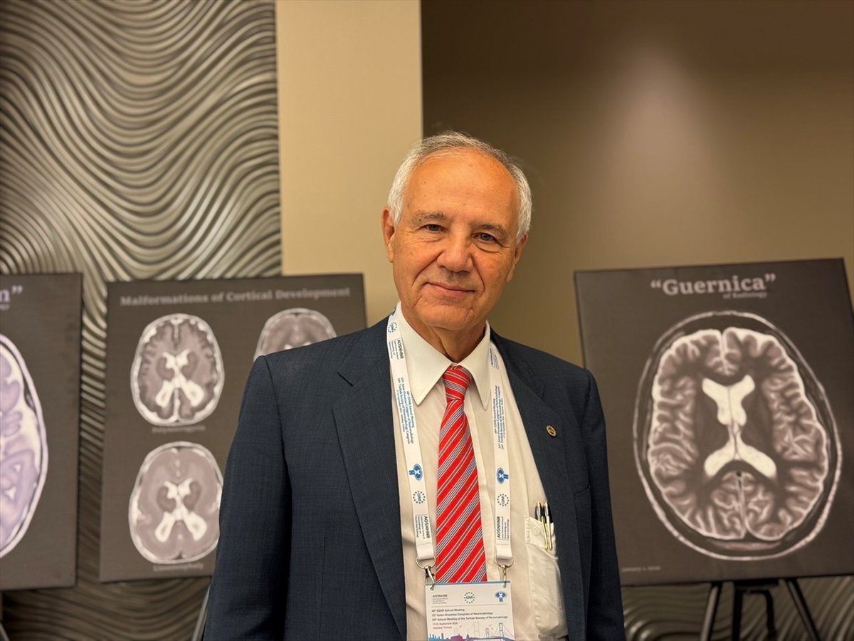 Türk bilim insanları, girişimsel nöroradyoloji uygulamalarında dünyada öncü rol oynuyor