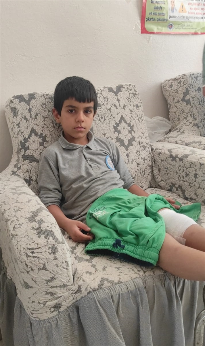 Bursa'da sahipsiz köpeğin saldırdığı çocuk bacağından yaralandı