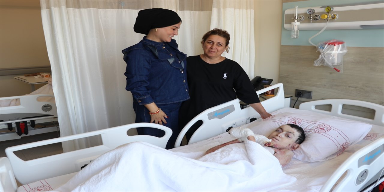 Kütahya’da ameliyat edilen Azerbaycanlı kelebek hastaları, yemek borusu ve elleri açılarak yaşam kalitesini artırdı