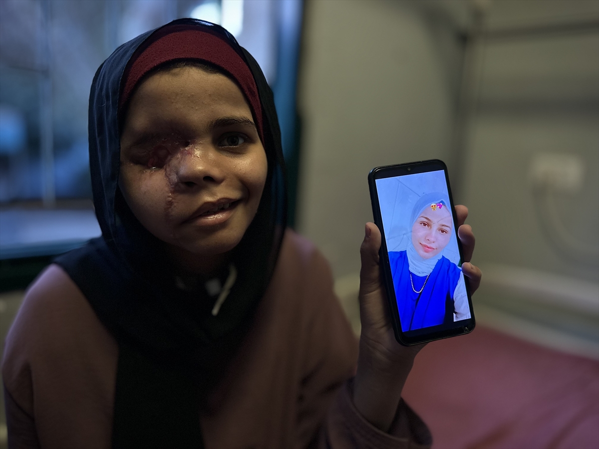 İsrail saldırısı nedeniyle yüzü tanınmaz hale gelen 15 yaşındaki Gazzeli Neda'nın "hayatı karardı"