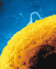 Kök hücreden güzel buluş