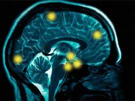 Beynin şifresi çözülüyor