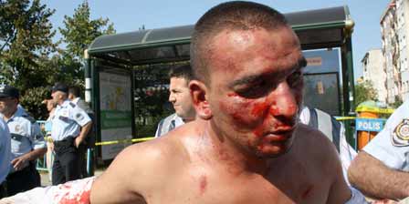 Birdal'a saldırdım çünkü;