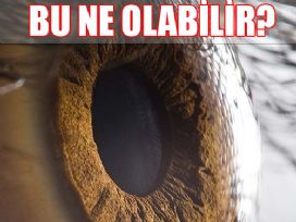 Sizce bu nedir?