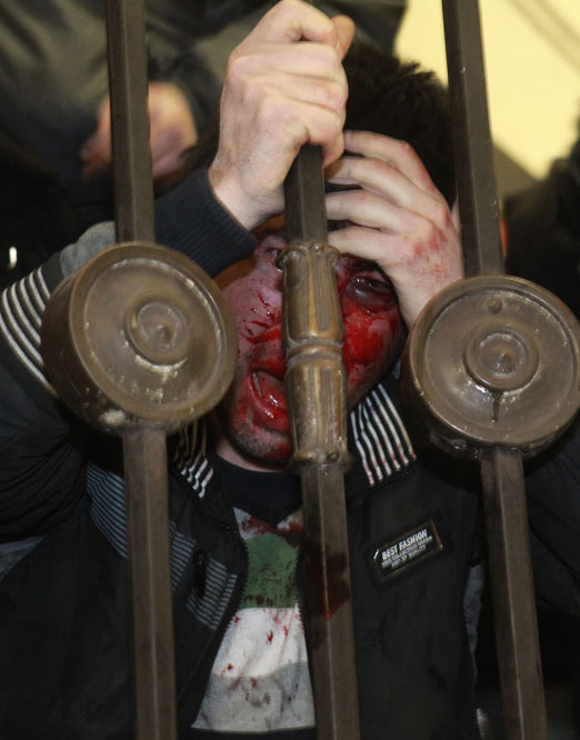 Kızıl Meydan kana bulandı!