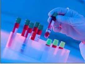 Kan hücrelerini sayan yeni kan testi yolda