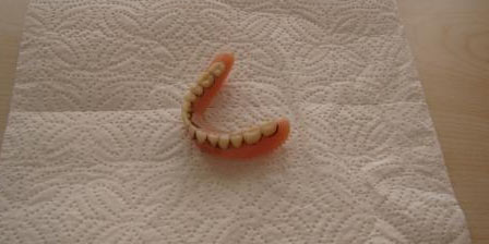 Yemek borusundan diş protezi çıkartıldı