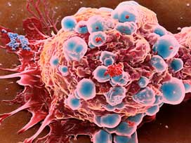 Zonguldak, kanserli hastalara umut