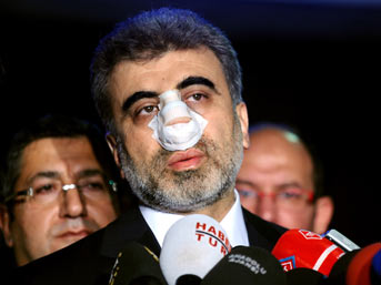 O yumruğun bedeli kaç yıl?