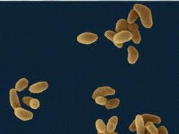 Tularemi'de erken teşhis dönemi