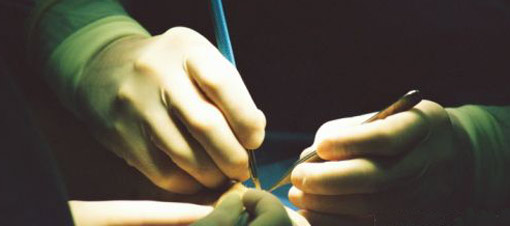 Artık gırtlak nakli de mümkün!