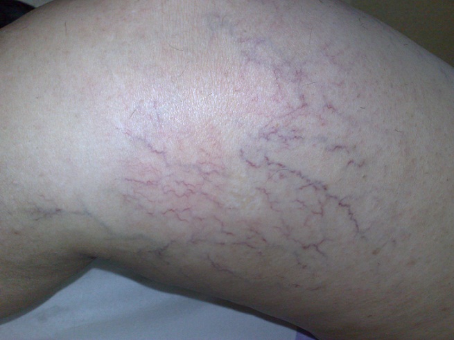 20 Dakikada varislerinizden kurtulun