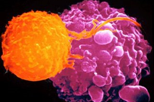 Böbrek kanseri riskini ARTIRIYOR