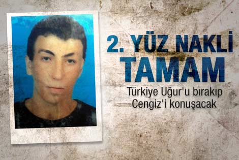 İkinci yüz nakli operasyonu tamam