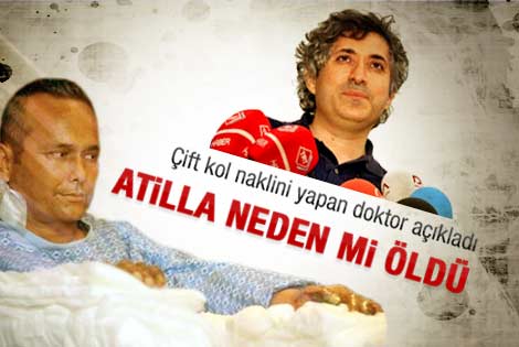 Çift kol naklini yapan doktor açıkladı