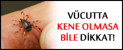Vücutta kene olmasa da dikkat edin