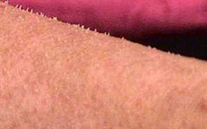 Doktorları şaşkına çeviren hastalık