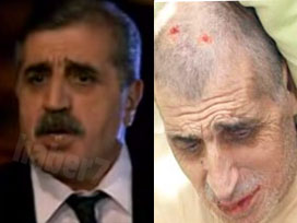 Usta oyuncu Kanserle Savaşıyor