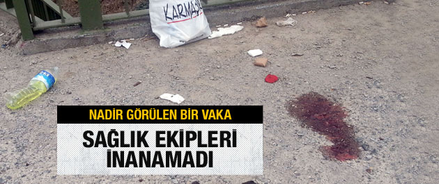 Yaralı kadın ağzından öyle bir şey çıkardı ki