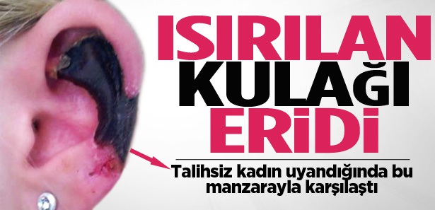 Örümcek kulağını resmen eritti