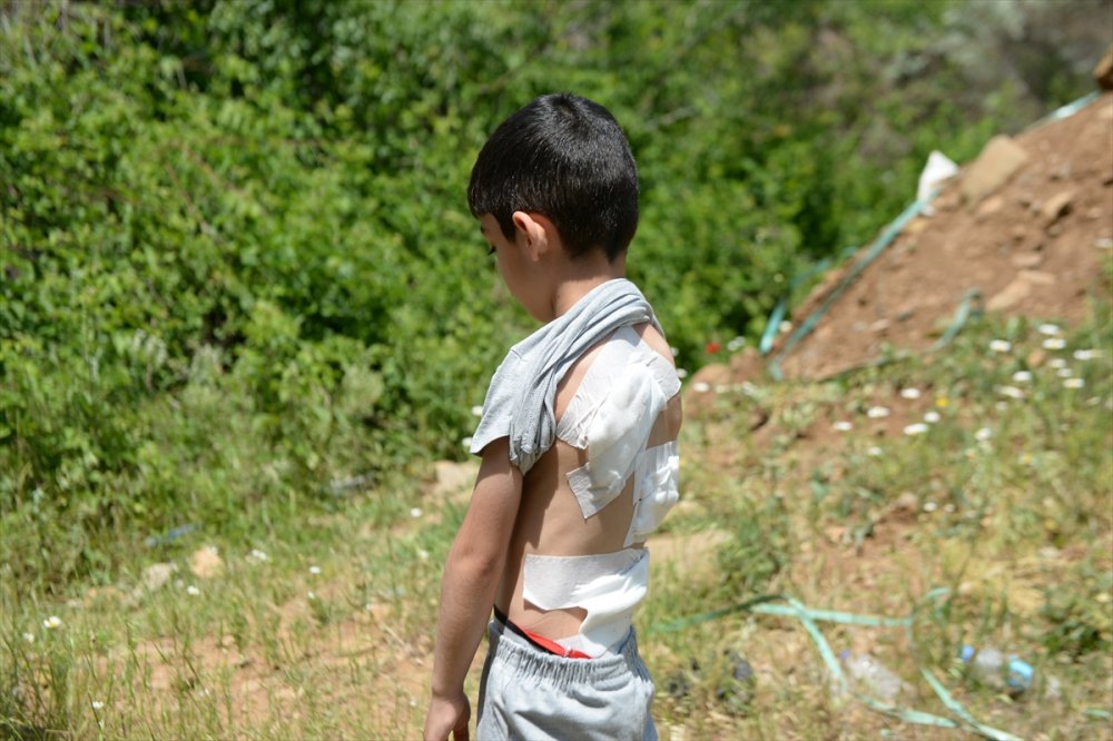 Bingöl'de sahipsiz köpeklerin saldırısında yaralanan çocuk tedavi edildi