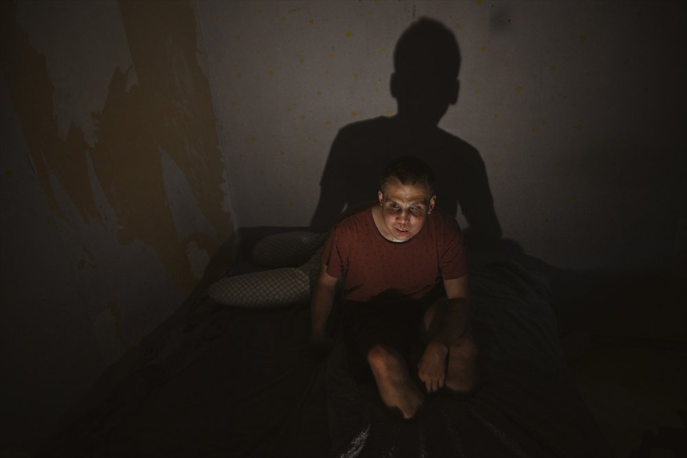 Ukrayna'daki savaşın acı yüzü: Gözlerini ve bacaklarını kaybeden Ukraynalı asker