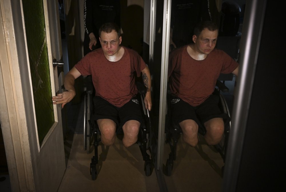 Ukrayna'daki savaşın acı yüzü: Gözlerini ve bacaklarını kaybeden Ukraynalı asker