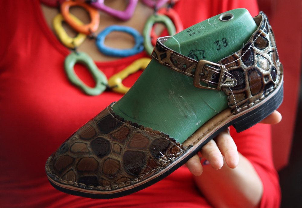 Geç iyileşen yaralardan korumak için "vurmayan ayakkabı" üretiliyor