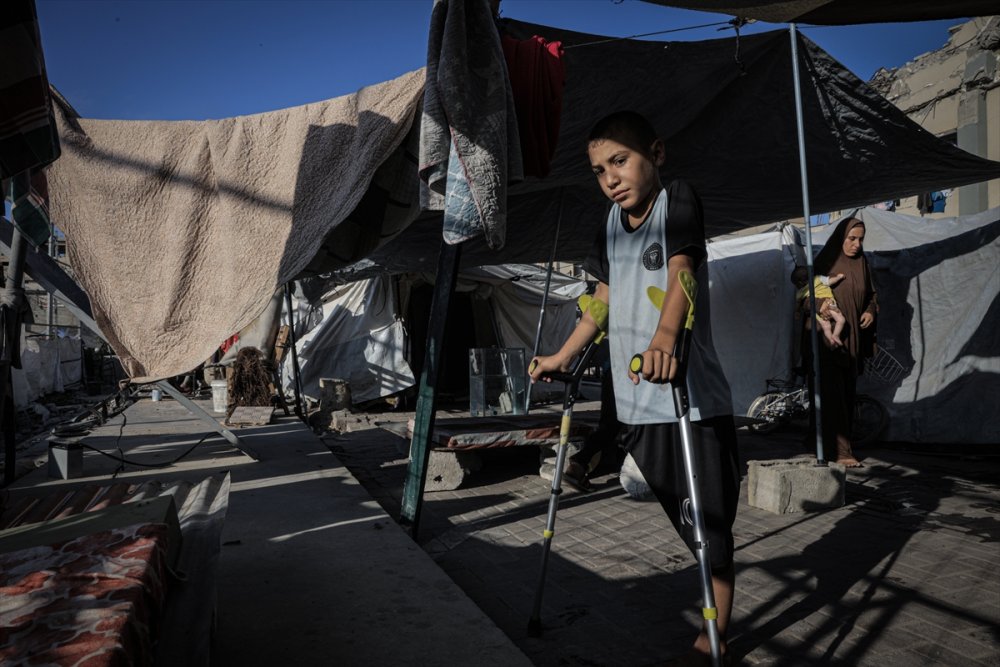 Yardım dağıtım noktasına giderken İsrail saldırısında ayağını kaybeden Gazzeli çocuk, eski günlerin özlemiyle yaşıyor