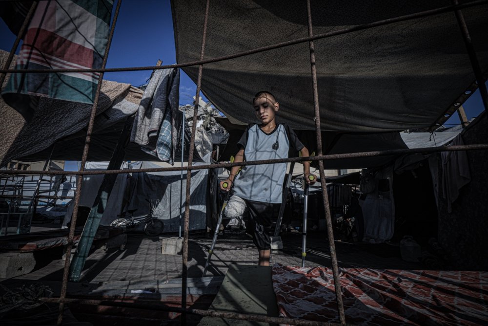 Yardım dağıtım noktasına giderken İsrail saldırısında ayağını kaybeden Gazzeli çocuk, eski günlerin özlemiyle yaşıyor