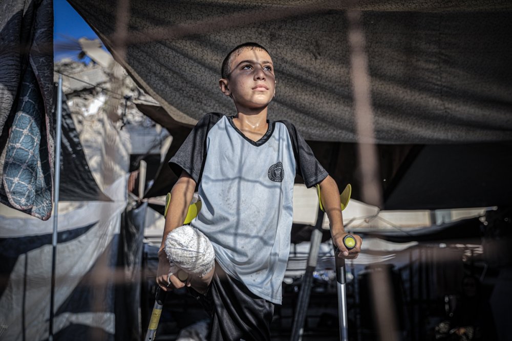 Yardım dağıtım noktasına giderken İsrail saldırısında ayağını kaybeden Gazzeli çocuk, eski günlerin özlemiyle yaşıyor