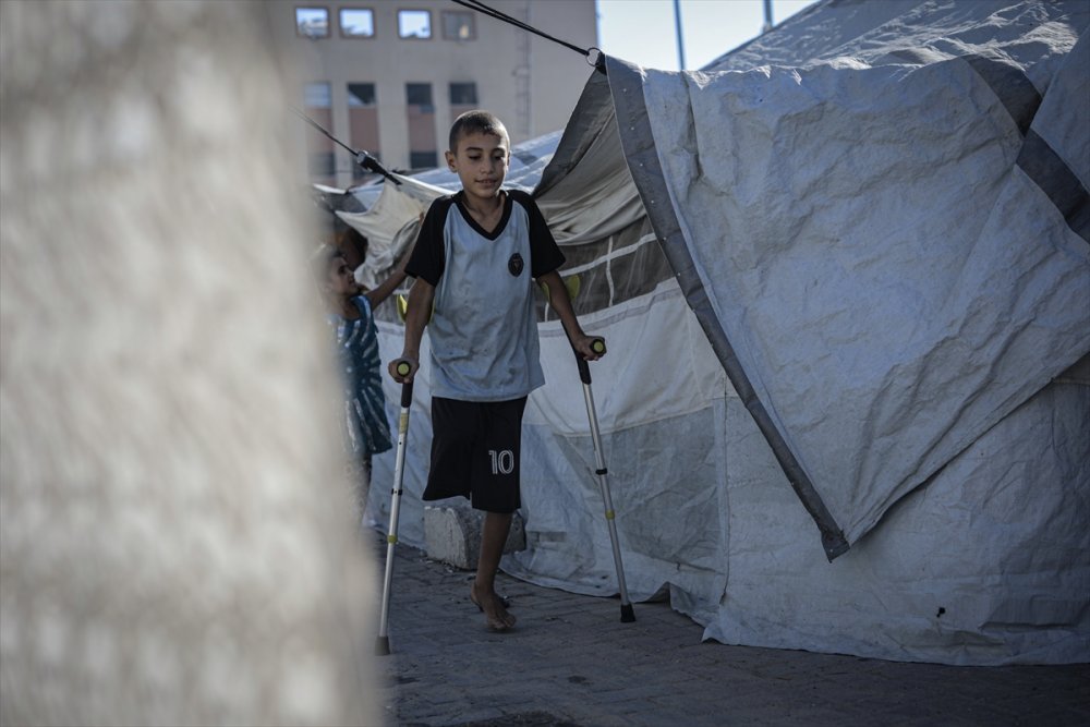 Yardım dağıtım noktasına giderken İsrail saldırısında ayağını kaybeden Gazzeli çocuk, eski günlerin özlemiyle yaşıyor