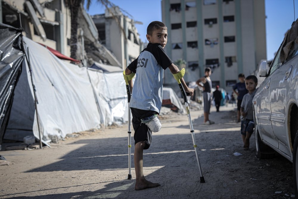 Yardım dağıtım noktasına giderken İsrail saldırısında ayağını kaybeden Gazzeli çocuk, eski günlerin özlemiyle yaşıyor