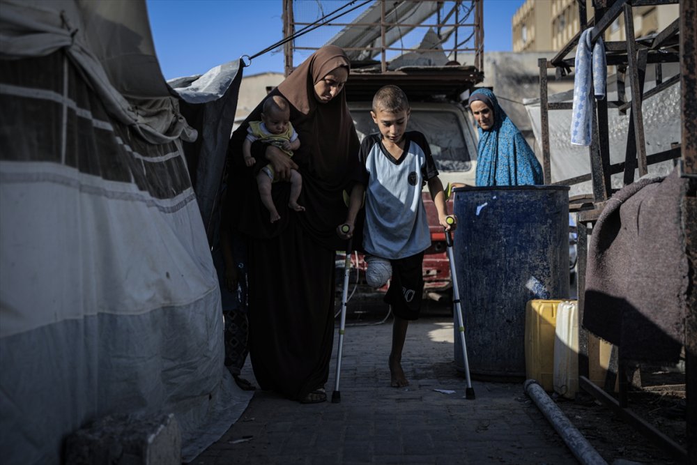 Yardım dağıtım noktasına giderken İsrail saldırısında ayağını kaybeden Gazzeli çocuk, eski günlerin özlemiyle yaşıyor